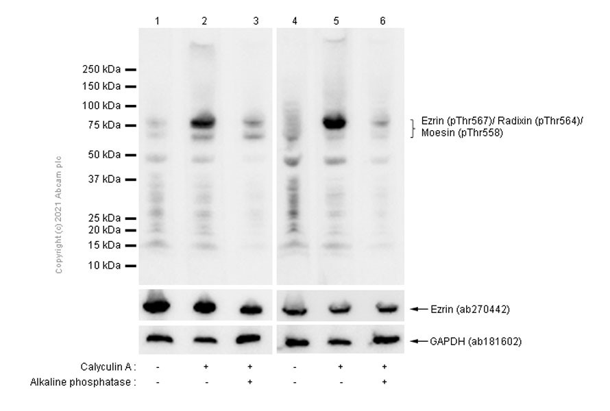Western blot - Anti-Ezrin (pThr567)/ Radixin (pThr564)/ Moesin (pThr558) antibody [EP2122Y] (AB76247), expandable thumbnail
