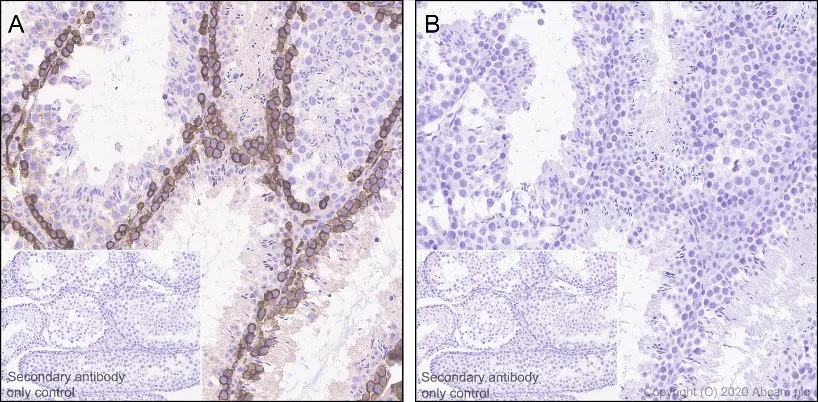 Immunohistochemistry (Formalin/PFA-fixed paraffin-embedded sections) - Anti-Ezrin (pThr567)/ Radixin (pThr564)/ Moesin (pThr558) antibody [EP2122Y] - BSA and Azide free (AB238957), expandable thumbnail