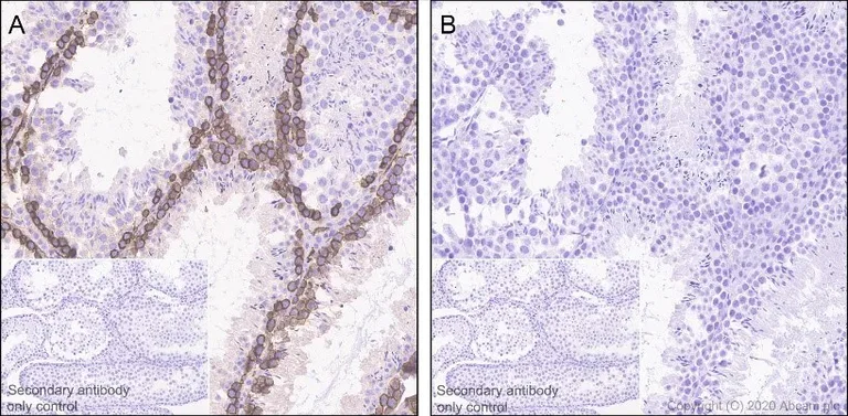 Immunohistochemistry (Formalin/PFA-fixed paraffin-embedded sections) - Anti-Ezrin (pThr567)/ Radixin (pThr564)/ Moesin (pThr558) antibody [EP2122Y] - BSA and Azide free (AB238957)