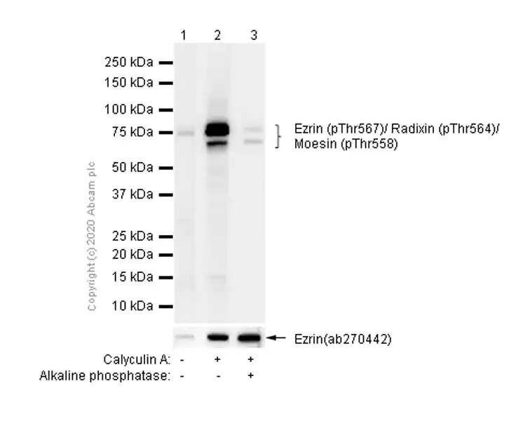 Western blot - Anti-Ezrin (pThr567)/ Radixin (pThr564)/ Moesin (pThr558) antibody [EP2122Y] - BSA and Azide free (ab238957), expandable thumbnail