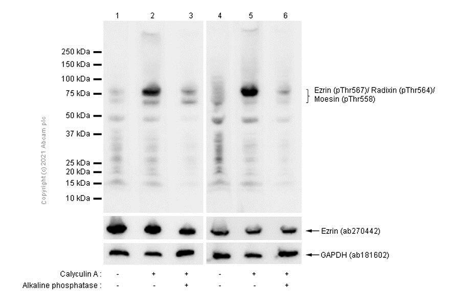 Western blot - Anti-Ezrin (pThr567)/ Radixin (pThr564)/ Moesin (pThr558) antibody [EP2122Y] - BSA and Azide free (AB238957), expandable thumbnail