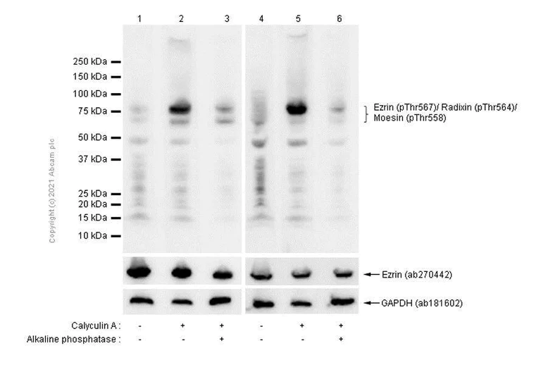 Western blot - Anti-Ezrin (pThr567)/ Radixin (pThr564)/ Moesin (pThr558) antibody [EP2122Y] - BSA and Azide free (AB238957)