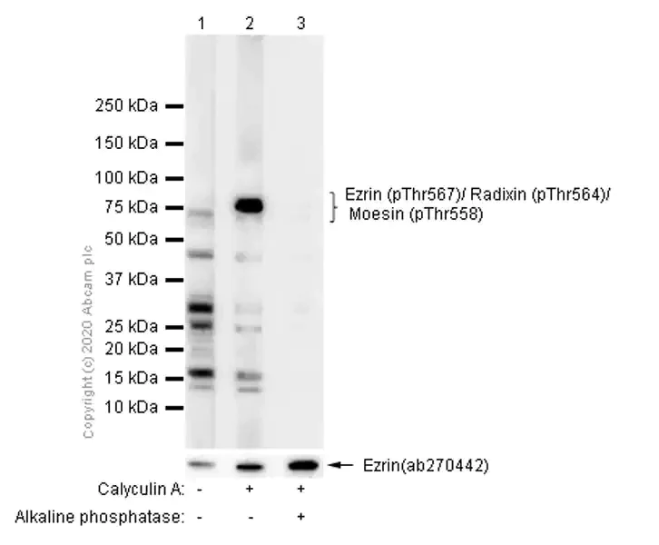 Western blot - Anti-Ezrin (pThr567)/ Radixin (pThr564)/ Moesin (pThr558) antibody [EP2122Y] - BSA and Azide free (AB238957)