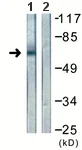 Western blot - Anti-Ezrin / Radixin / Moesin antibody (AB118572)