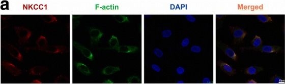 Immunocytochemistry/ Immunofluorescence - Anti-F-actin antibody [NH3] (AB205)