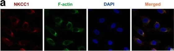 Immunocytochemistry/ Immunofluorescence - Anti-F-actin antibody [NH3] (AB205)