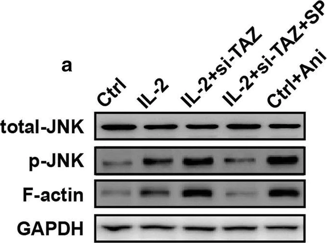 Western blot - Anti-F-actin antibody [NH3] (AB205)