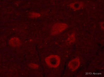 Immunocytochemistry/ Immunofluorescence - F-actin Staining Kit - Red Fluorescence - Cytopainter (AB112127), expandable thumbnail