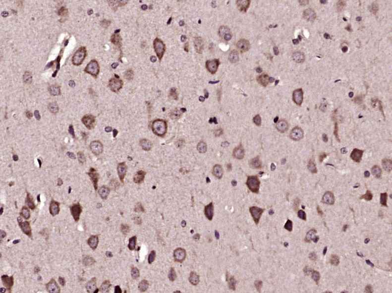 Immunohistochemistry (Formalin/PFA-fixed paraffin-embedded sections) - Anti-F-spondin antibody (AB215165)