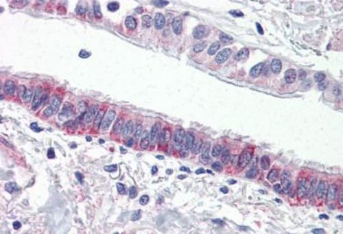 Immunohistochemistry (Formalin/PFA-fixed paraffin-embedded sections) - Anti-F2RL3 antibody - N-terminal (AB188930)