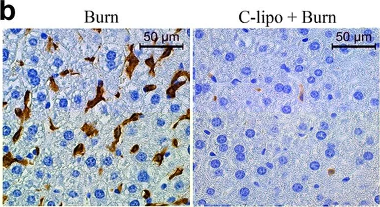 Immunocytochemistry - Anti-F4/80 antibody - C-terminal (AB186073)