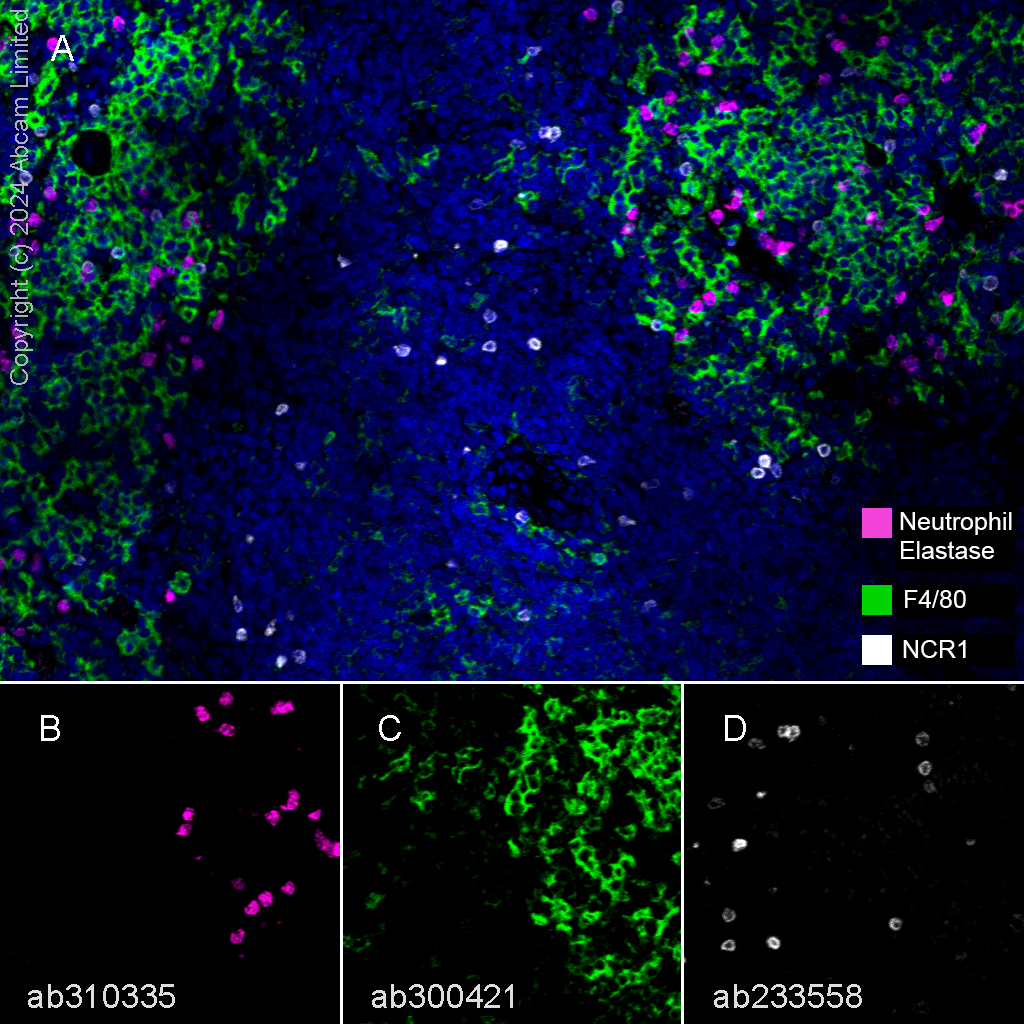 Multiplex immunohistochemistry - Anti-F4/80 antibody [EPR26545-166] (ab300421), expandable thumbnail