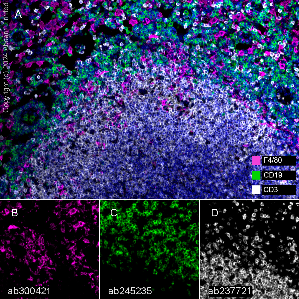 Multiplex immunohistochemistry - Anti-F4/80 antibody [EPR26545-166] (ab300421), expandable thumbnail