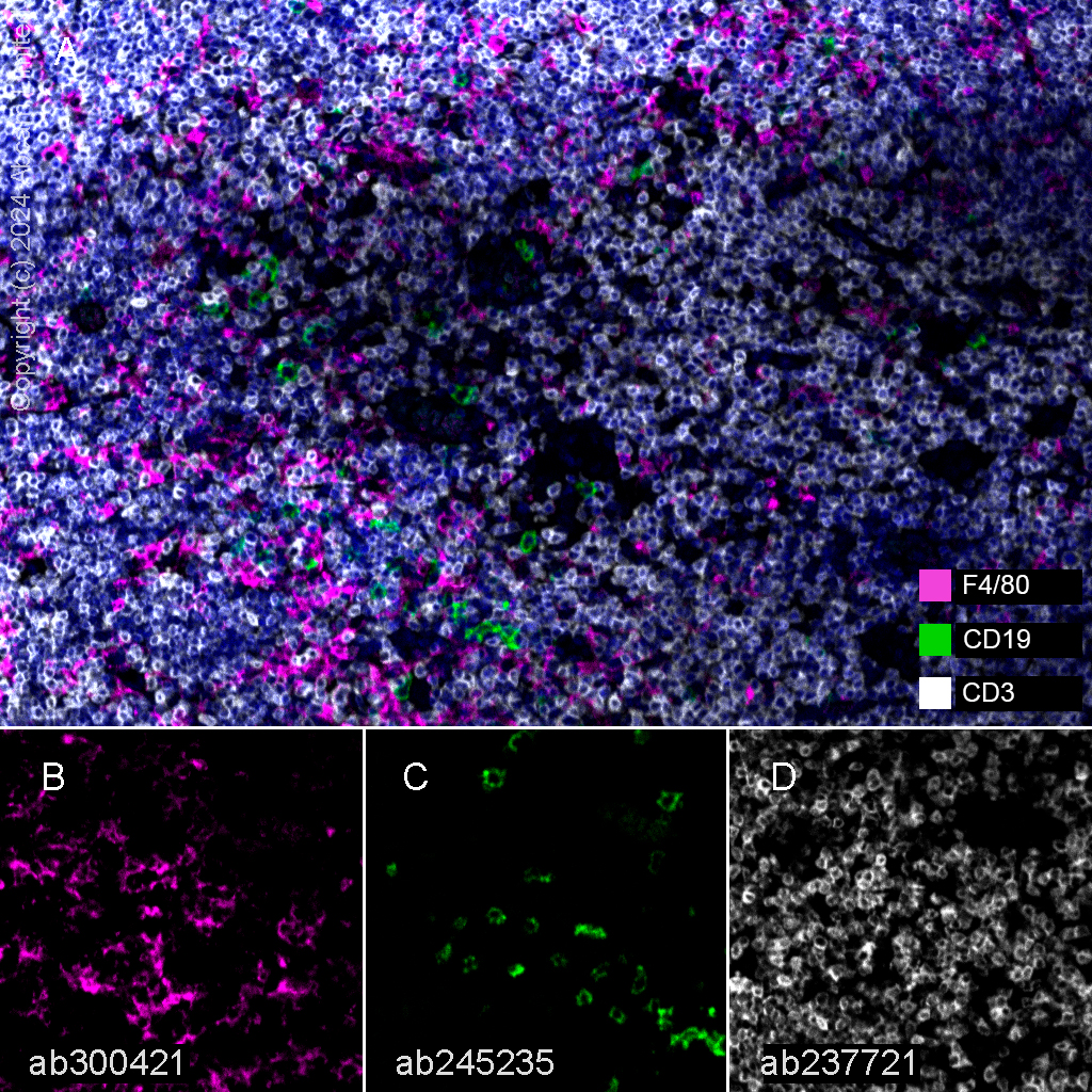 Multiplex immunohistochemistry - Anti-F4/80 antibody [EPR26545-166] (ab300421), expandable thumbnail