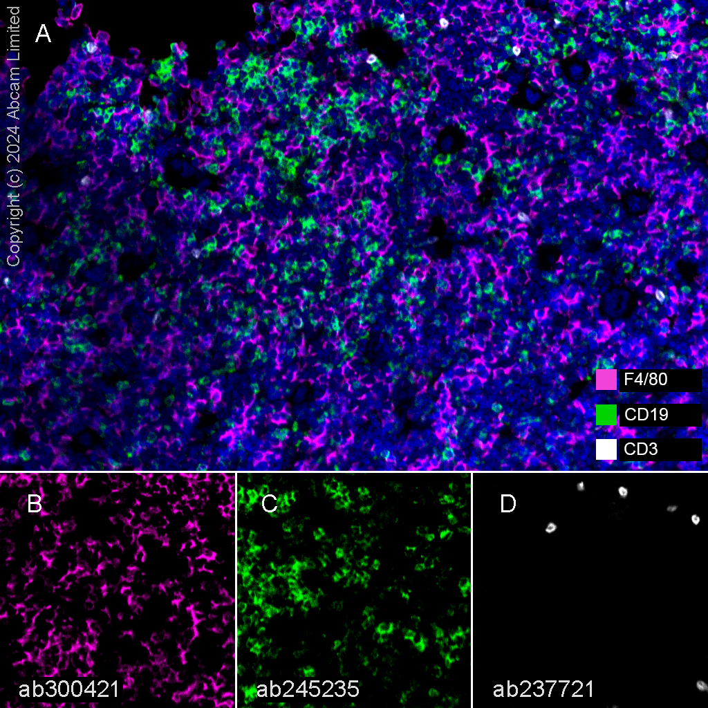 Multiplex immunohistochemistry - Anti-F4/80 antibody [EPR26545-166] (AB300421), expandable thumbnail