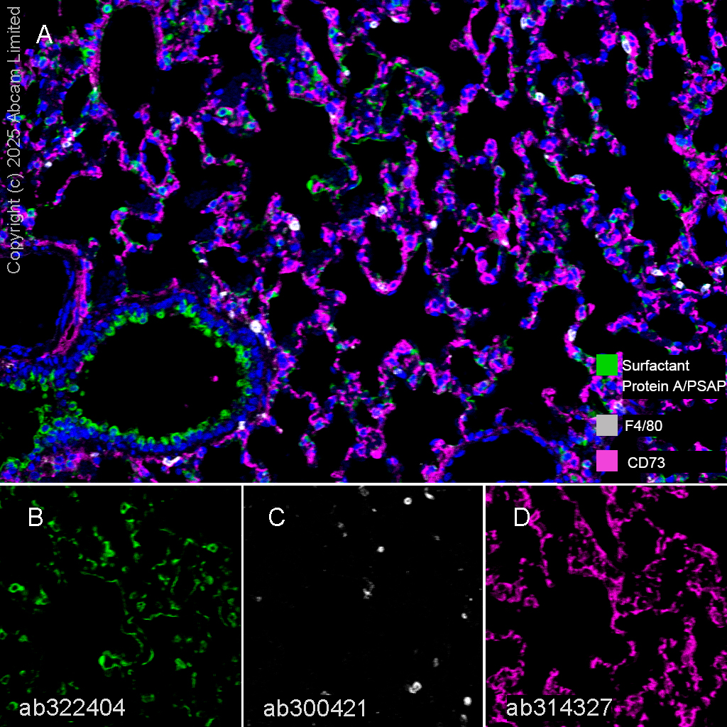 Multiplex immunohistochemistry - Anti-F4/80 antibody [EPR26545-166] (AB300421), expandable thumbnail