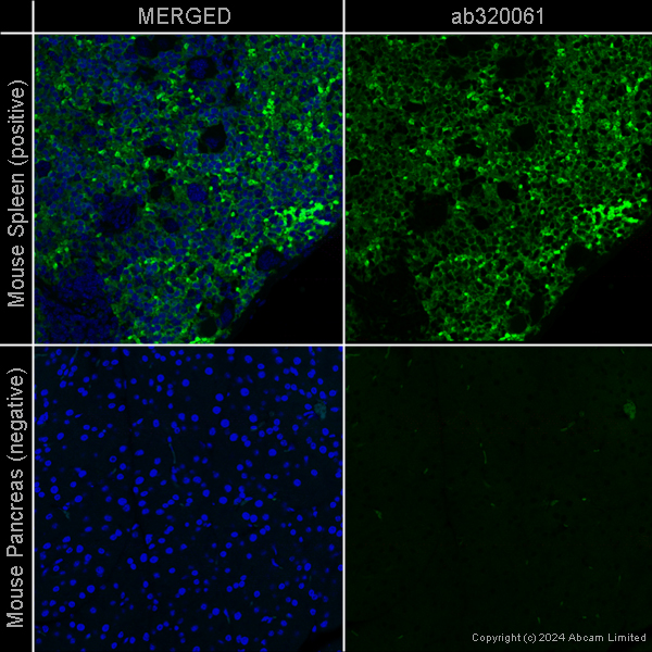 Immunohistochemistry (Formalin/PFA-fixed paraffin-embedded sections) - Anti-F4/80 antibody [EPR26545-166] – Chicken IgY (Chimeric) – BSA and Azide Free (AB320061), expandable thumbnail