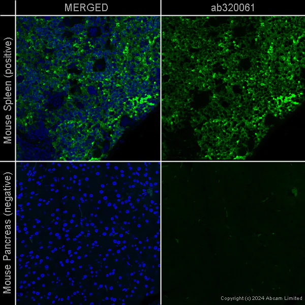 Immunohistochemistry (Formalin/PFA-fixed paraffin-embedded sections) - Anti-F4/80 antibody [EPR26545-166] – Chicken IgY (Chimeric) – BSA and Azide Free (AB320061)