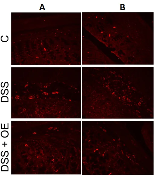 Immunohistochemistry (Formalin/PFA-fixed paraffin-embedded sections) - Anti-F4/80 antibody [SP115] - BSA and Azide free (AB240946)