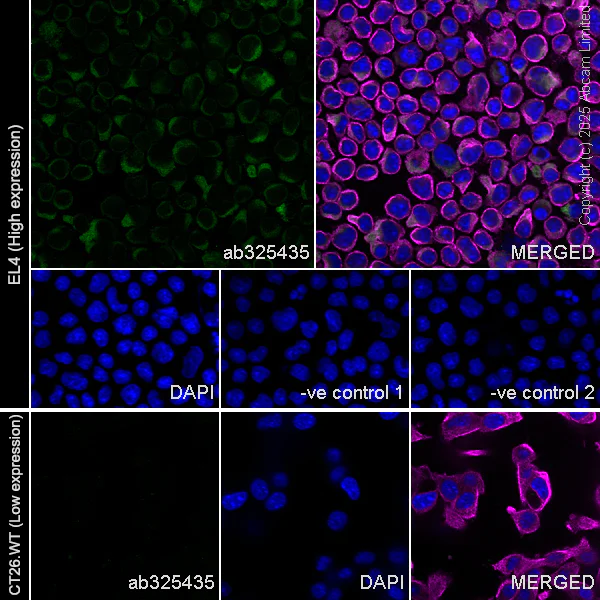 Immunocytochemistry/ Immunofluorescence - Anti-FAAH1 antibody [EPR30112-48] (AB325435)