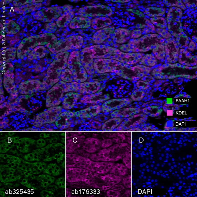 Multiplex immunohistochemistry - Anti-FAAH1 antibody [EPR30112-48] (AB325435)
