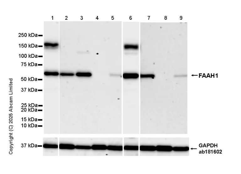 Western blot - Anti-FAAH1 antibody [EPR30112-48] (AB325435)