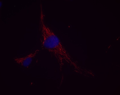 Immunocytochemistry - Anti-FABP-1 antibody [8D2BB12] (AB113693)