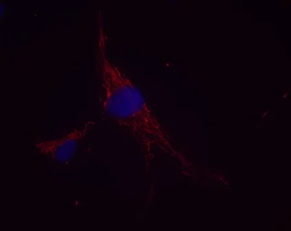 Immunocytochemistry - Anti-FABP-1 antibody [8D2BB12] (AB113693)