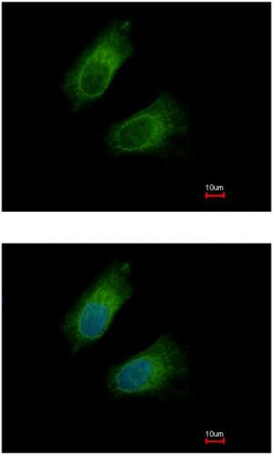 Immunocytochemistry/ Immunofluorescence - Anti-FABP-1 antibody (AB153924), expandable thumbnail