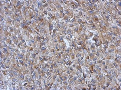 Immunohistochemistry (Formalin/PFA-fixed paraffin-embedded sections) - Anti-FABP-1 antibody (AB153924), expandable thumbnail