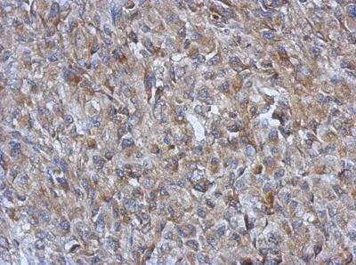 Immunohistochemistry (Formalin/PFA-fixed paraffin-embedded sections) - Anti-FABP-1 antibody (AB153924)
