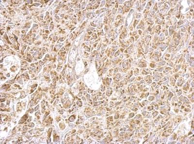 Immunohistochemistry (Formalin/PFA-fixed paraffin-embedded sections) - Anti-FABP-1 antibody (ab153924), expandable thumbnail