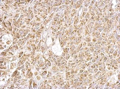 Immunohistochemistry (Formalin/PFA-fixed paraffin-embedded sections) - Anti-FABP-1 antibody (AB153924)