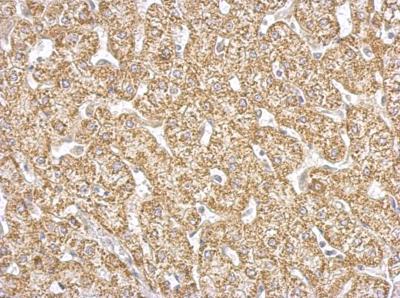Immunohistochemistry (Formalin/PFA-fixed paraffin-embedded sections) - Anti-FABP-1 antibody (ab153924), expandable thumbnail