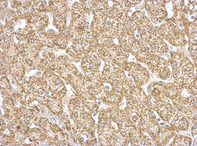 Immunohistochemistry (Formalin/PFA-fixed paraffin-embedded sections) - Anti-FABP-1 antibody (AB153924)