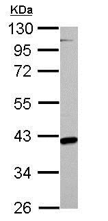 Western blot - Anti-FABP-1 antibody (AB153924), expandable thumbnail