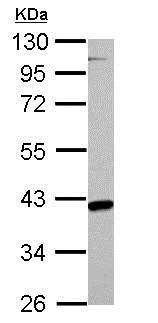 Western blot - Anti-FABP-1 antibody (AB153924)