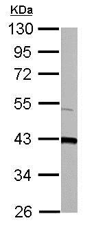 Western blot - Anti-FABP-1 antibody (AB153924), expandable thumbnail