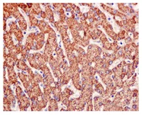 Immunohistochemistry (Formalin/PFA-fixed paraffin-embedded sections) - Anti-FABP-1 antibody [EPR12354(B)] (AB171739)