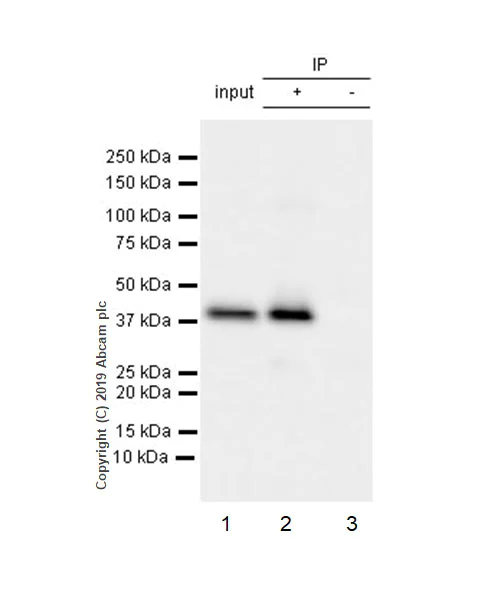 Immunoprecipitation - Anti-FABP-1 antibody [EPR12354(B)] (AB171739)