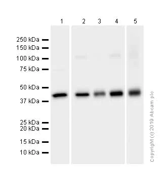 Western blot - Anti-FABP-1 antibody [EPR12354(B)] (AB171739)