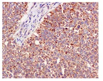 Immunohistochemistry (Formalin/PFA-fixed paraffin-embedded sections) - Anti-FABP-1 antibody [EPR12354(B)] - BSA and Azide free (AB240164)
