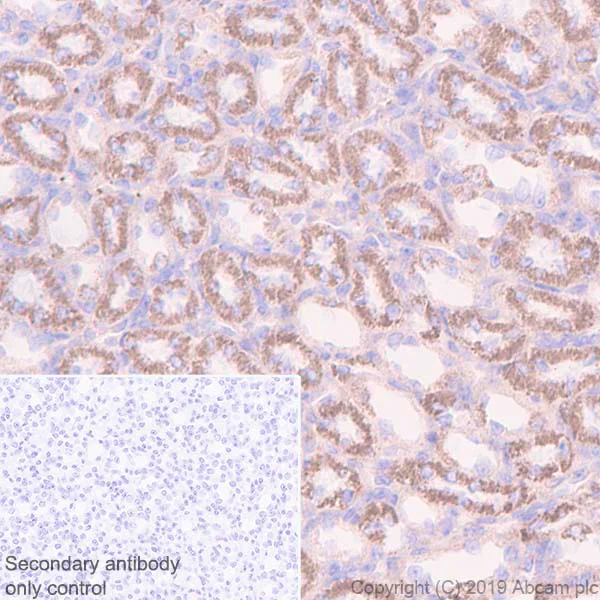 Immunohistochemistry (Formalin/PFA-fixed paraffin-embedded sections) - Anti-FABP-1 antibody [EPR12354(B)] - BSA and Azide free (AB240164)