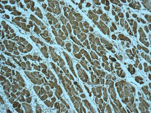 Immunohistochemistry (Formalin/PFA-fixed paraffin-embedded sections) - Anti-FABP-1 antibody [EPR12355(B)] (AB180162), expandable thumbnail