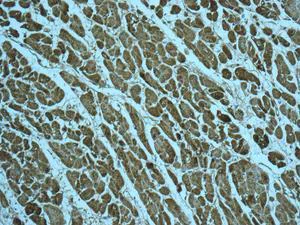Immunohistochemistry (Formalin/PFA-fixed paraffin-embedded sections) - Anti-FABP-1 antibody [EPR12355(B)] - BSA and Azide free (AB250167)