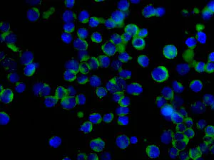 Immunocytochemistry/ Immunofluorescence - Anti-FABP12 antibody [EPR10536] (AB155089)