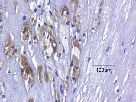 Immunohistochemistry (Formalin/PFA-fixed paraffin-embedded sections) - Anti-FABP4 antibody (AB13979)