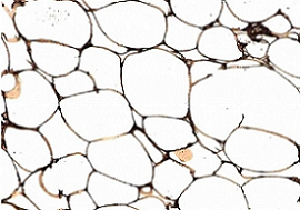 Immunohistochemistry (Formalin/PFA-fixed paraffin-embedded sections) - Anti-FABP4 antibody (AB13979)