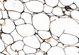 Immunohistochemistry (Formalin/PFA-fixed paraffin-embedded sections) - Anti-FABP4 antibody (AB13979)