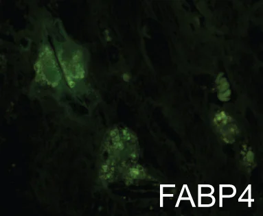 Immunohistochemistry (Formalin/PFA-fixed paraffin-embedded sections) - Anti-FABP4 antibody (AB13979)